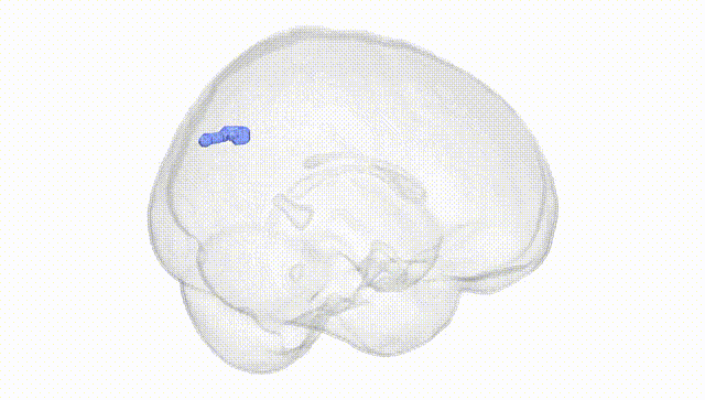 Full Brain White
