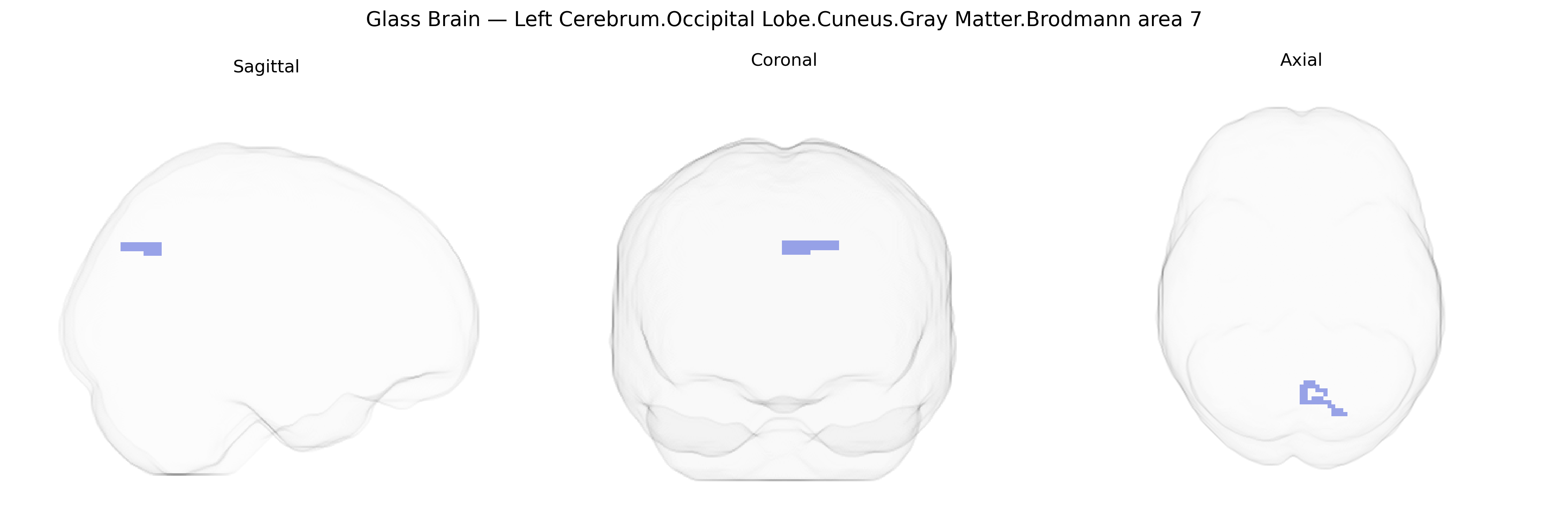 Triplanar Ghost Brain