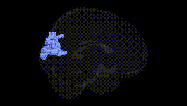 Full Brain Black