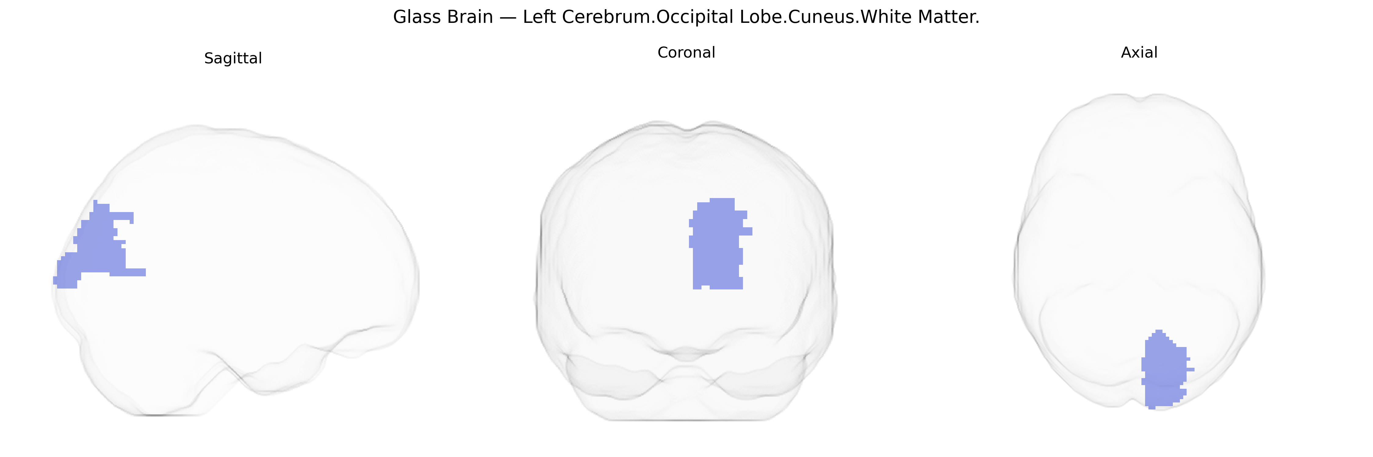 Triplanar Ghost Brain