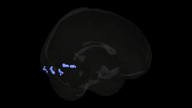 Full Brain Black