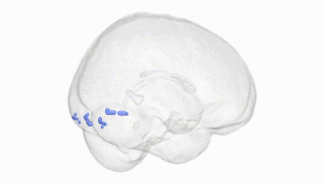 Full Brain White