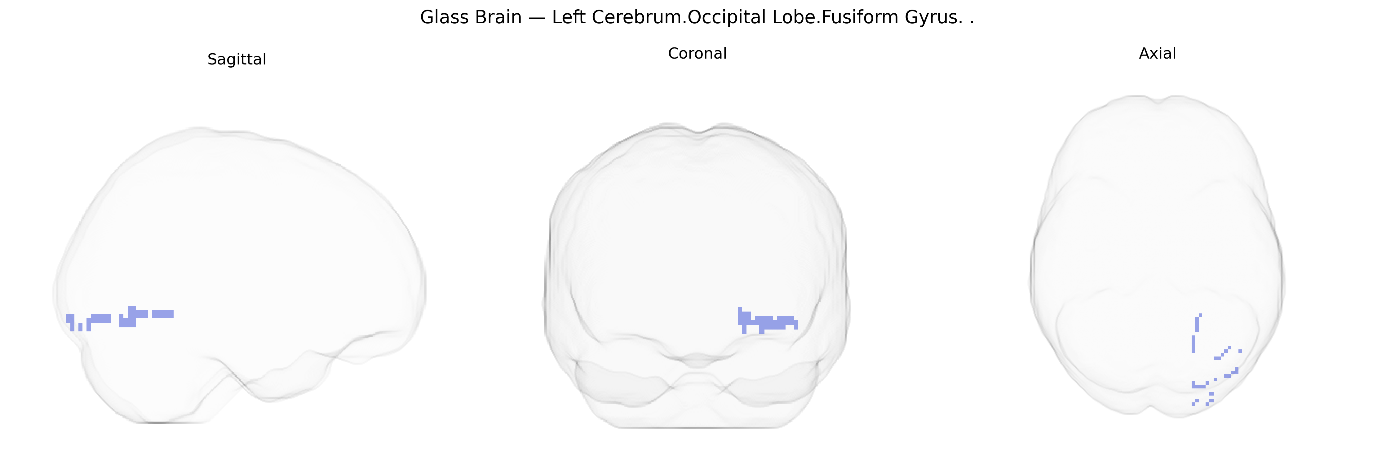 Triplanar Ghost Brain