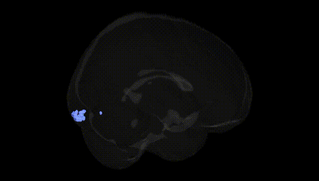 Full Brain Black