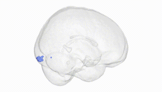Full Brain White