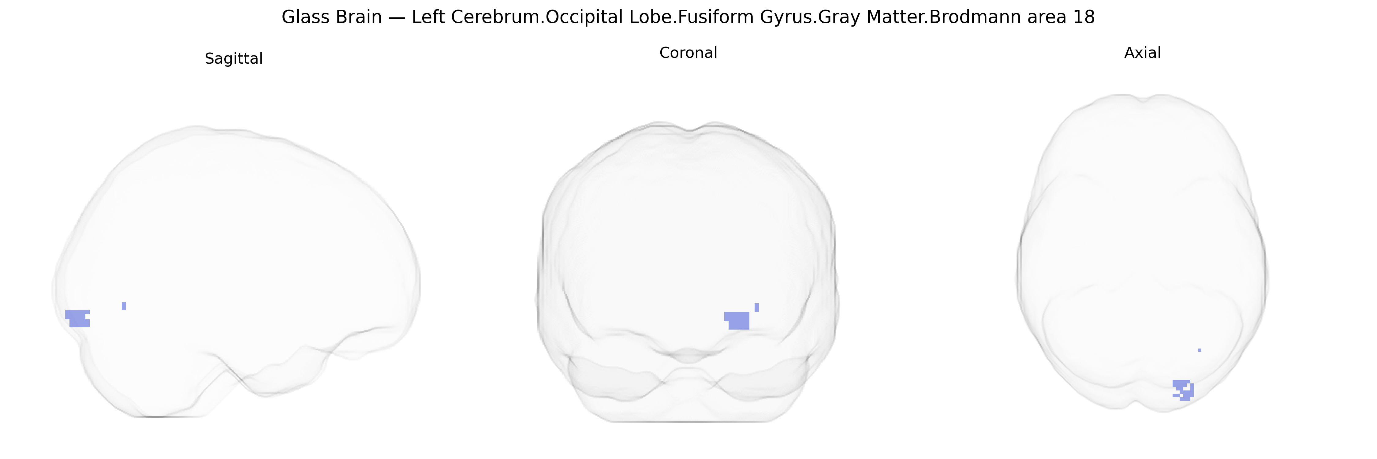 Triplanar Ghost Brain