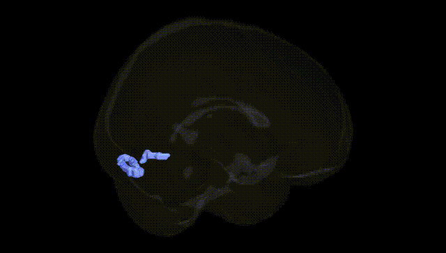 Full Brain Black