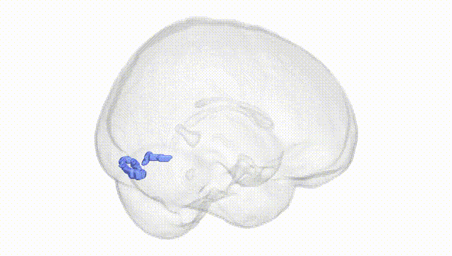 Full Brain White