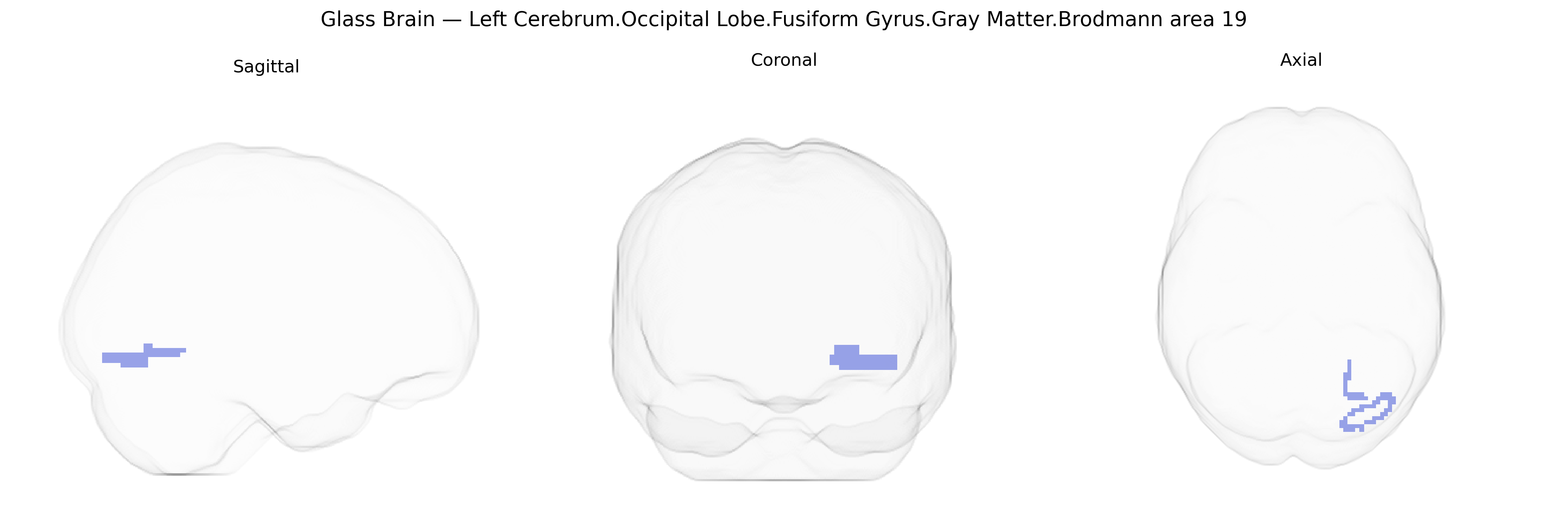 Triplanar Ghost Brain