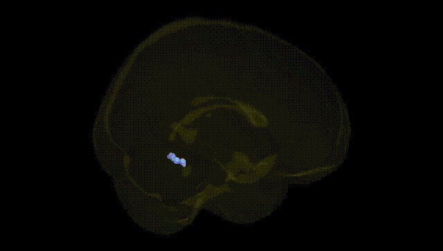 Full Brain Black
