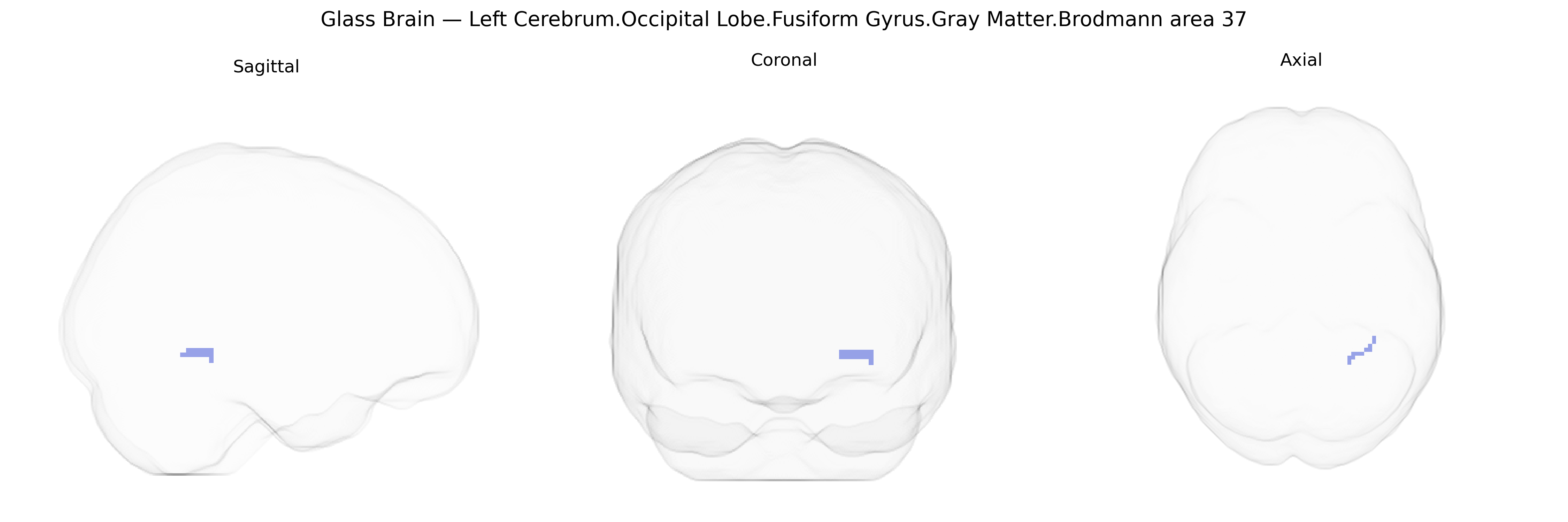 Triplanar Ghost Brain