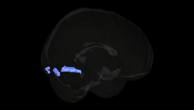 Full Brain Black
