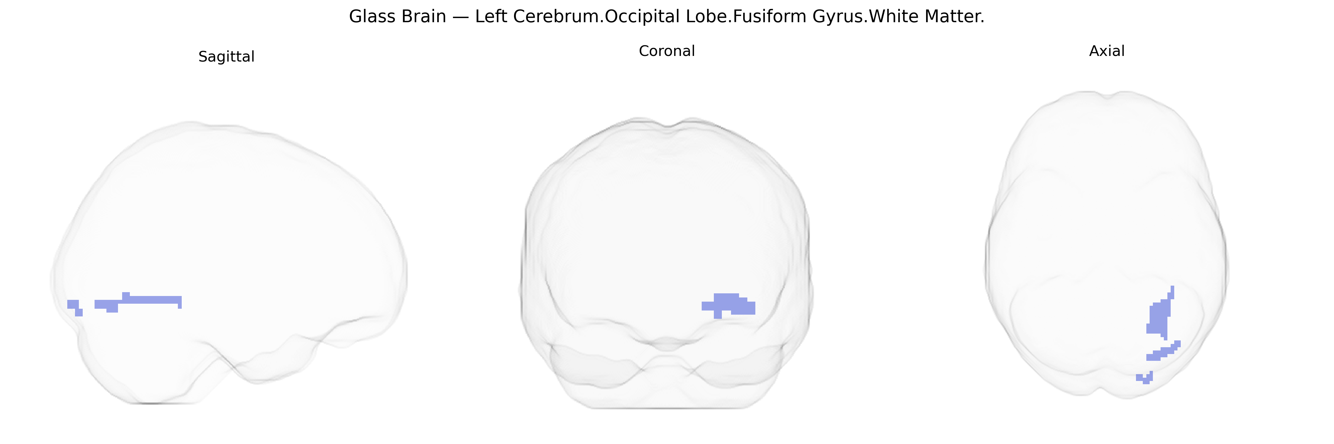 Triplanar Ghost Brain