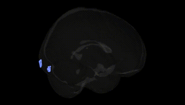 Full Brain Black