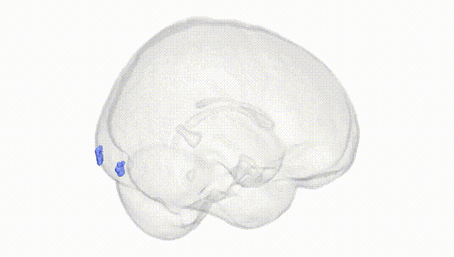 Full Brain White