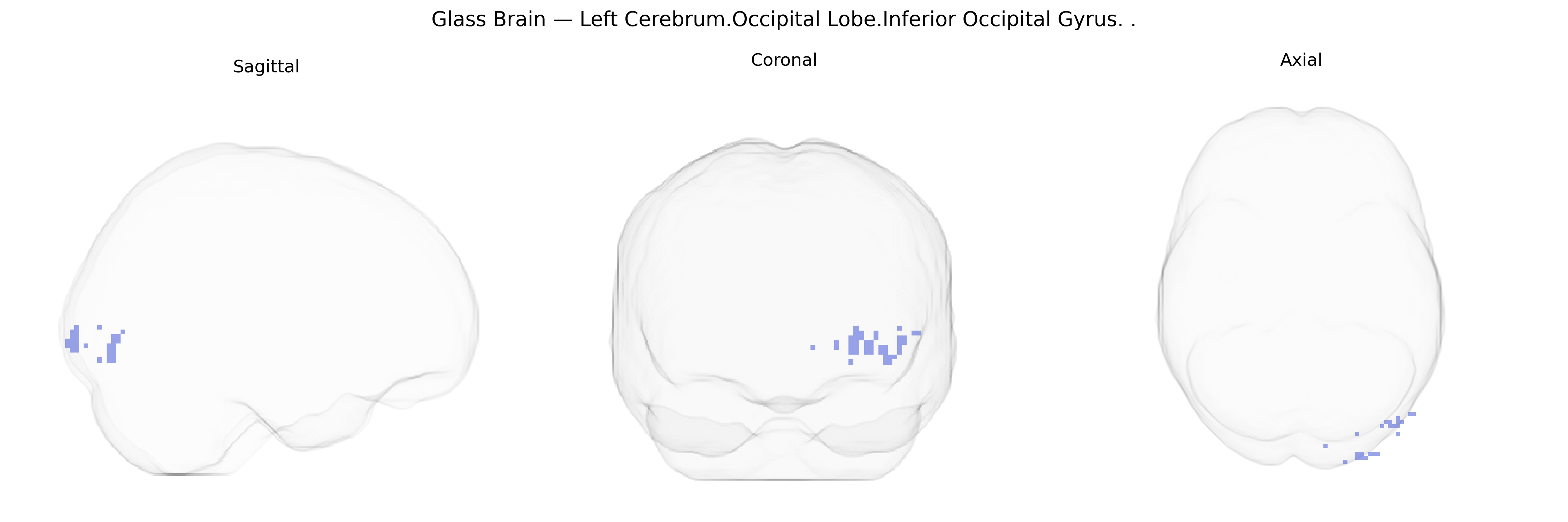 Triplanar Ghost Brain
