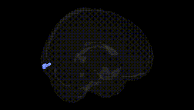 Full Brain Black