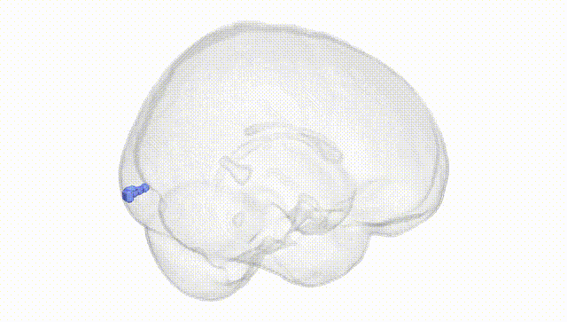 Full Brain White