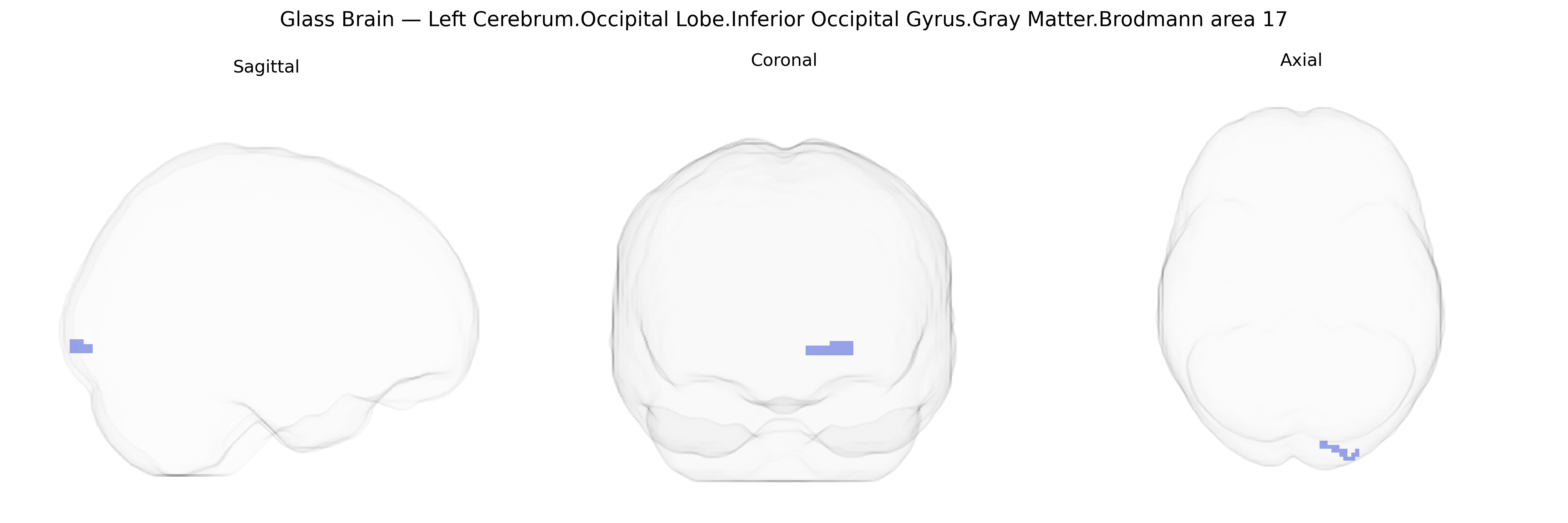 Triplanar Ghost Brain