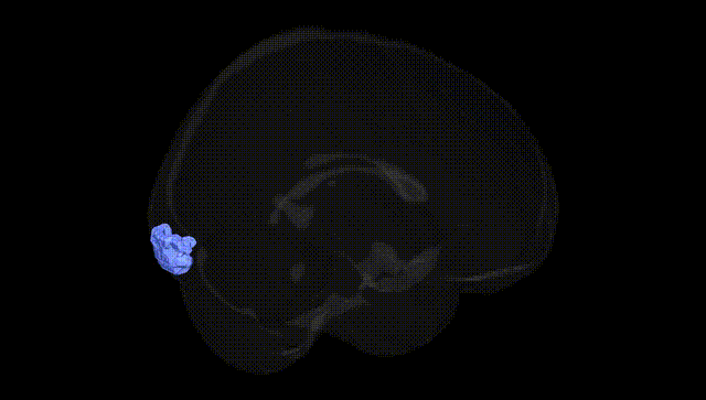Full Brain Black