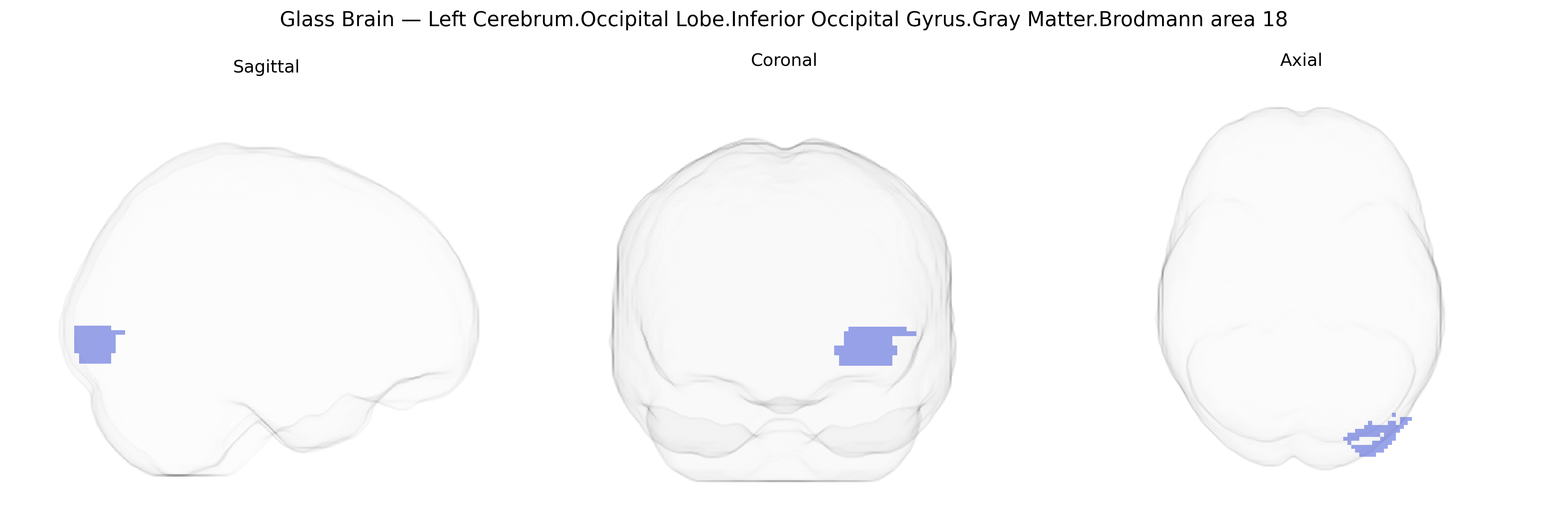 Triplanar Ghost Brain