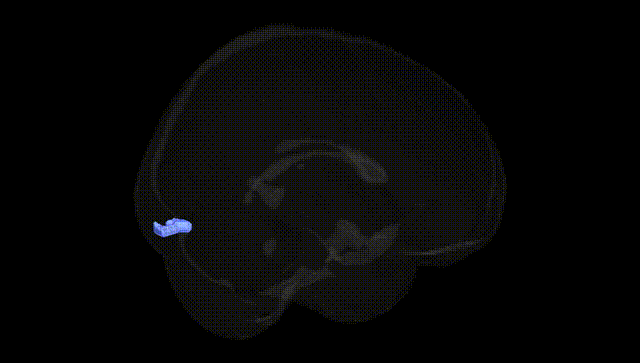 Full Brain Black