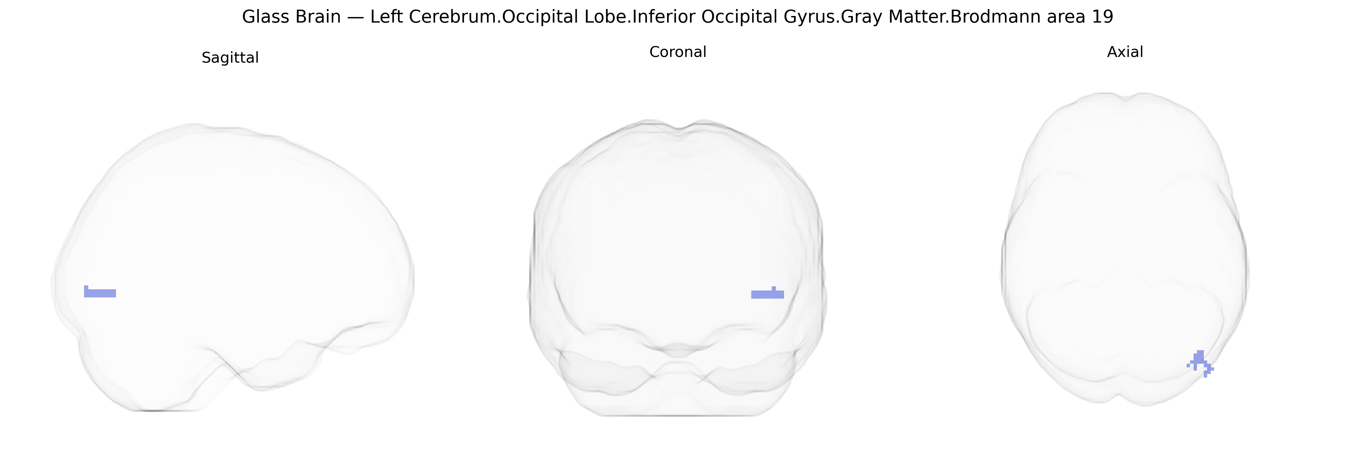 Triplanar Ghost Brain