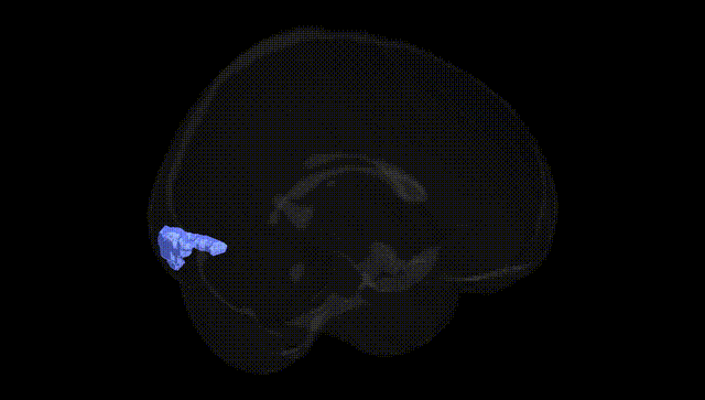 Full Brain Black