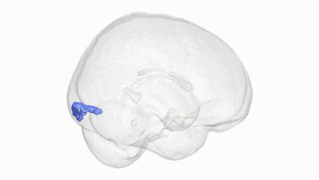 Full Brain White