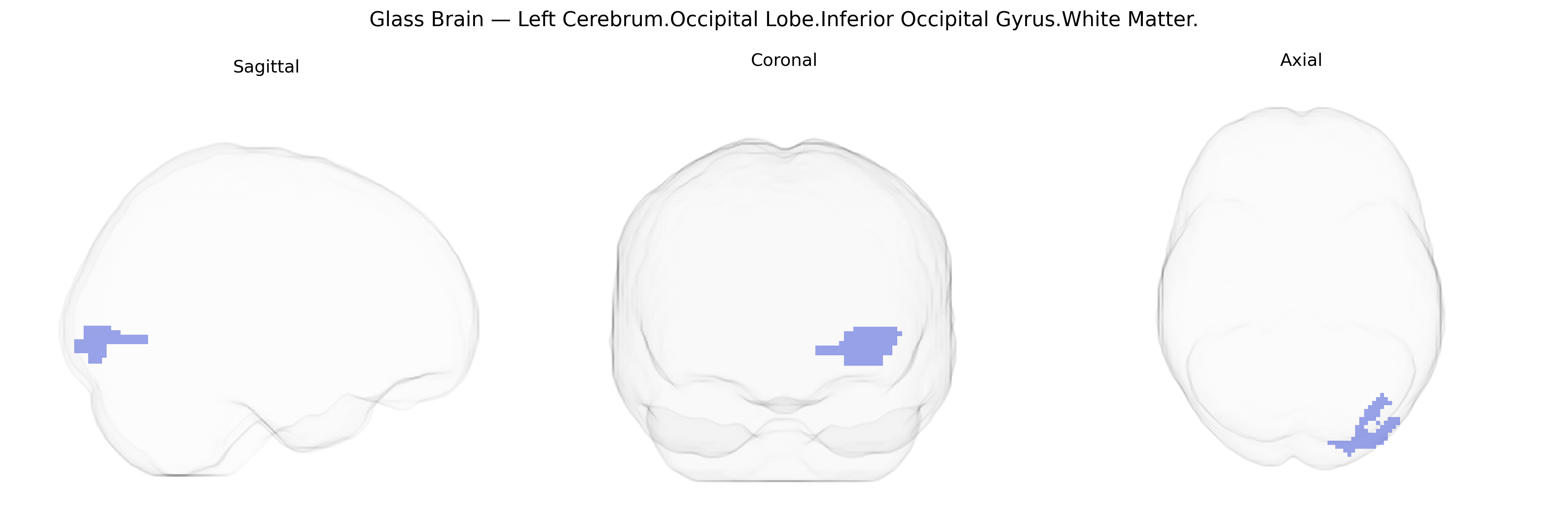 Triplanar Ghost Brain