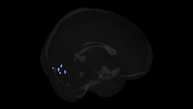Full Brain Black