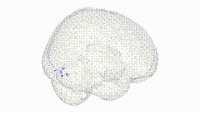 Full Brain White