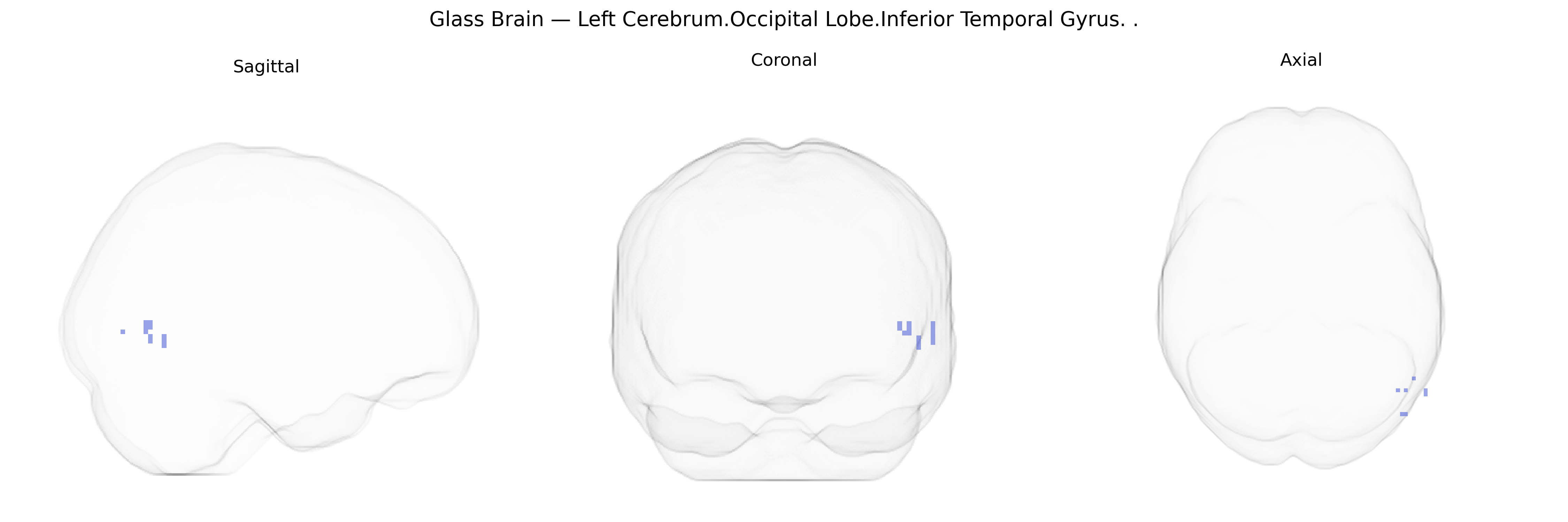 Triplanar Ghost Brain