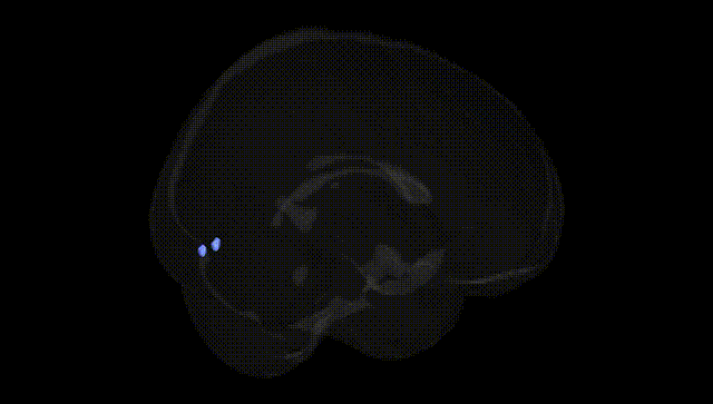 Full Brain Black