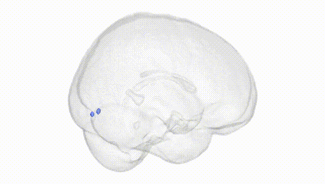 Full Brain White
