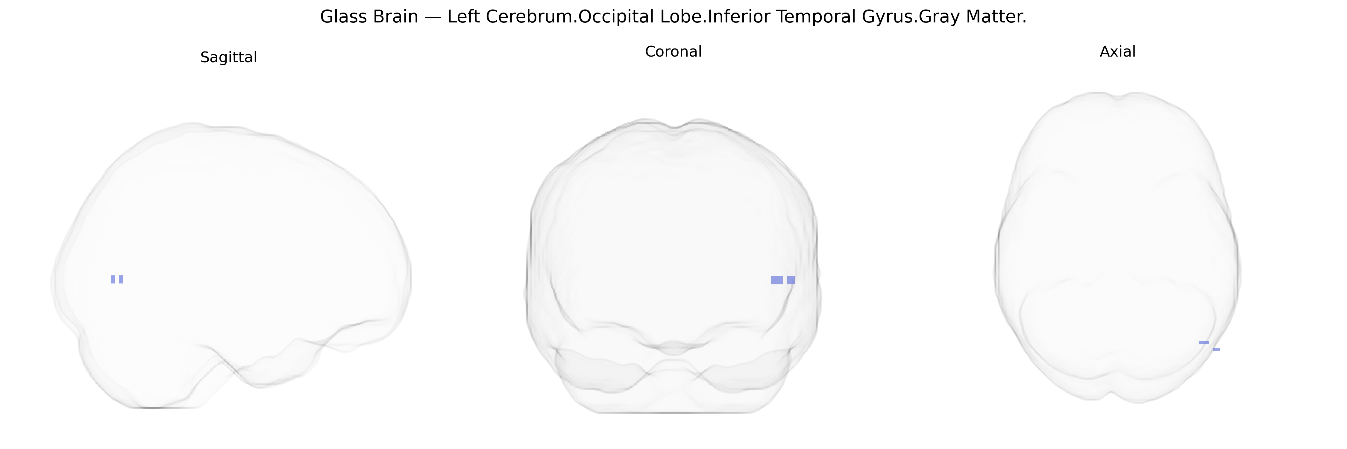 Triplanar Ghost Brain