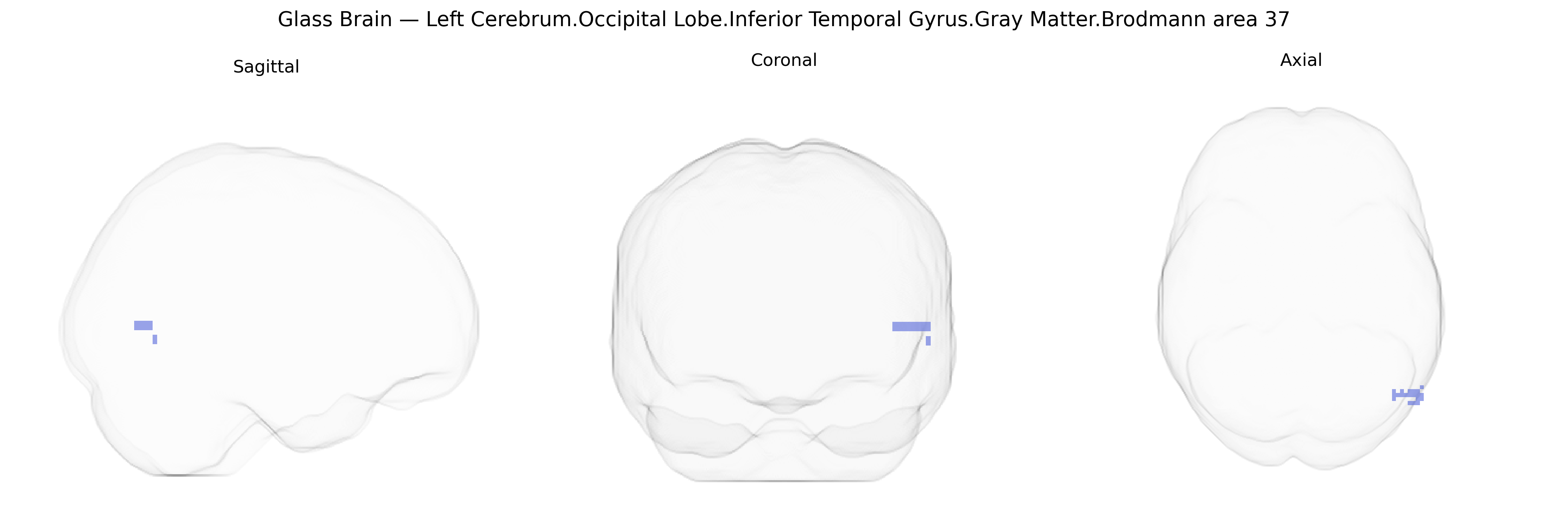 Triplanar Ghost Brain