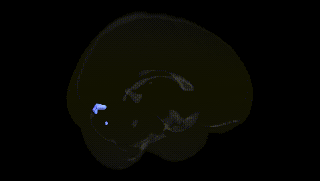 Full Brain Black