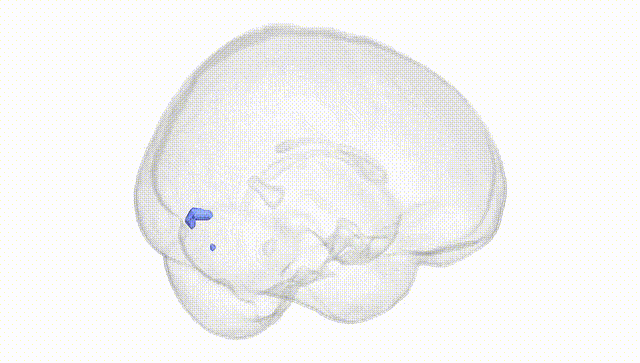 Full Brain White