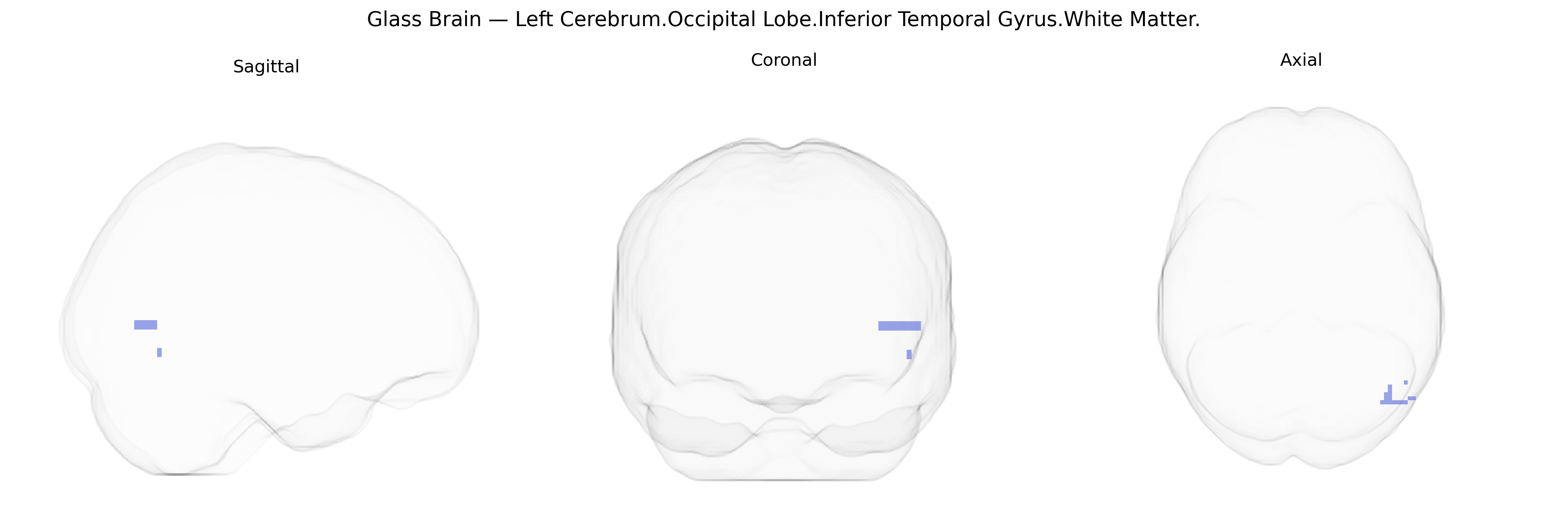 Triplanar Ghost Brain