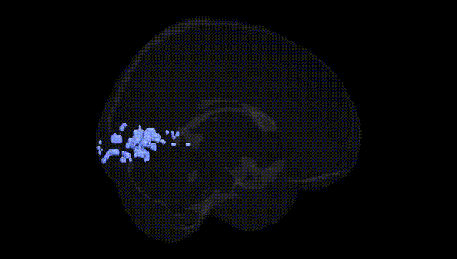 Full Brain Black