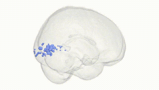 Full Brain White