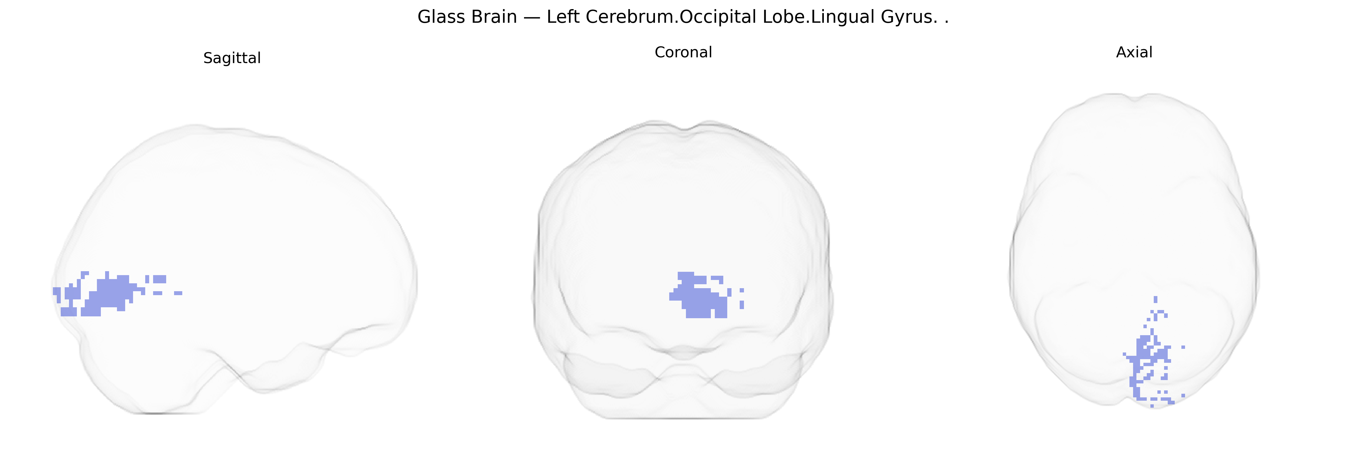 Triplanar Ghost Brain