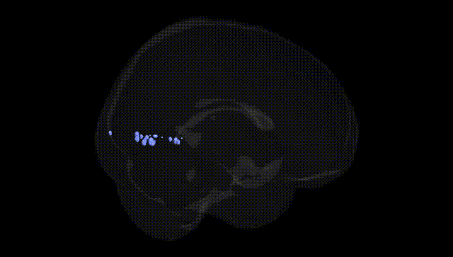 Full Brain Black