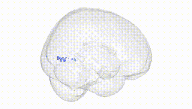 Full Brain White