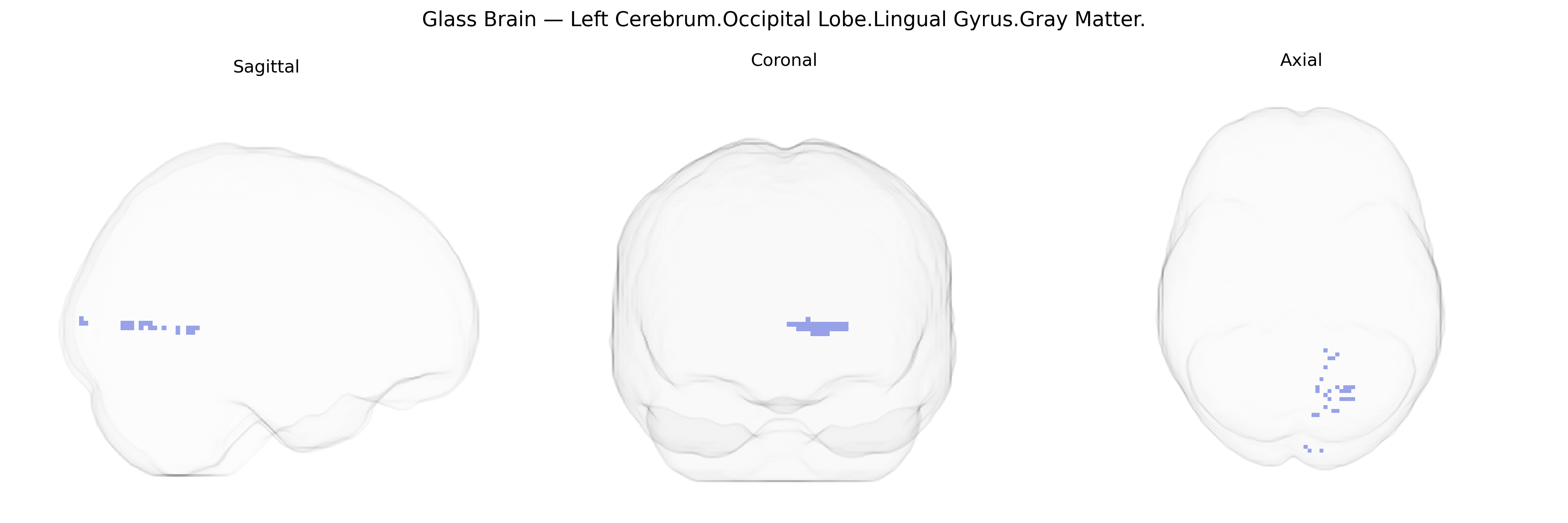 Triplanar Ghost Brain