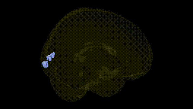 Full Brain Black