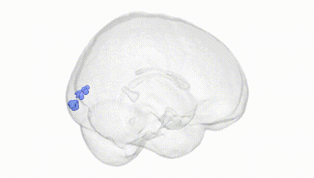 Full Brain White