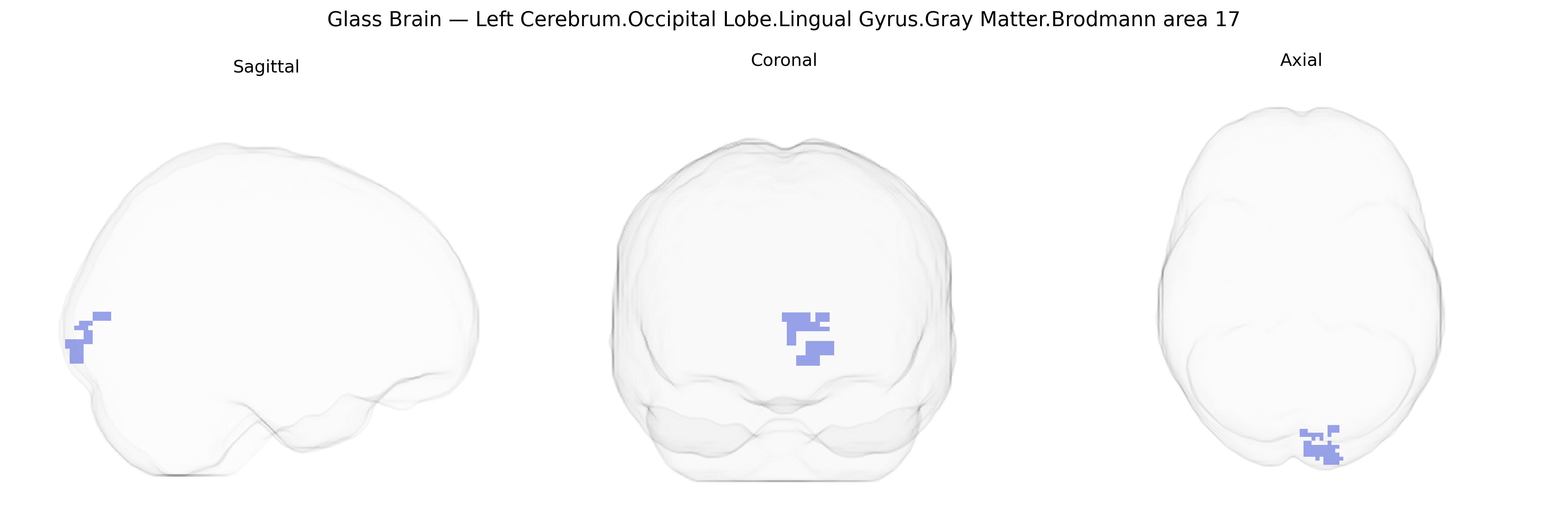 Triplanar Ghost Brain