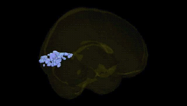 Full Brain Black